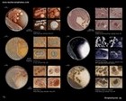 gram negative rods